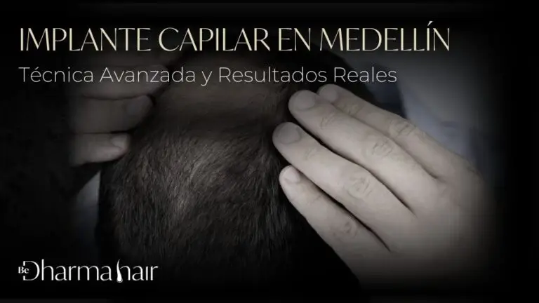 Implante capilar en Medellín - Be Dharma Hair en Medellín