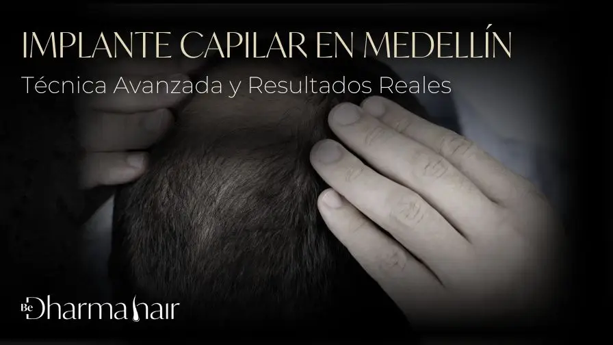 Implante capilar en Medellín - Be Dharma Hair en Medellín