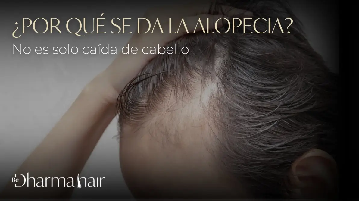 ¿Por qué se da la alopecia?-Dharma Hair