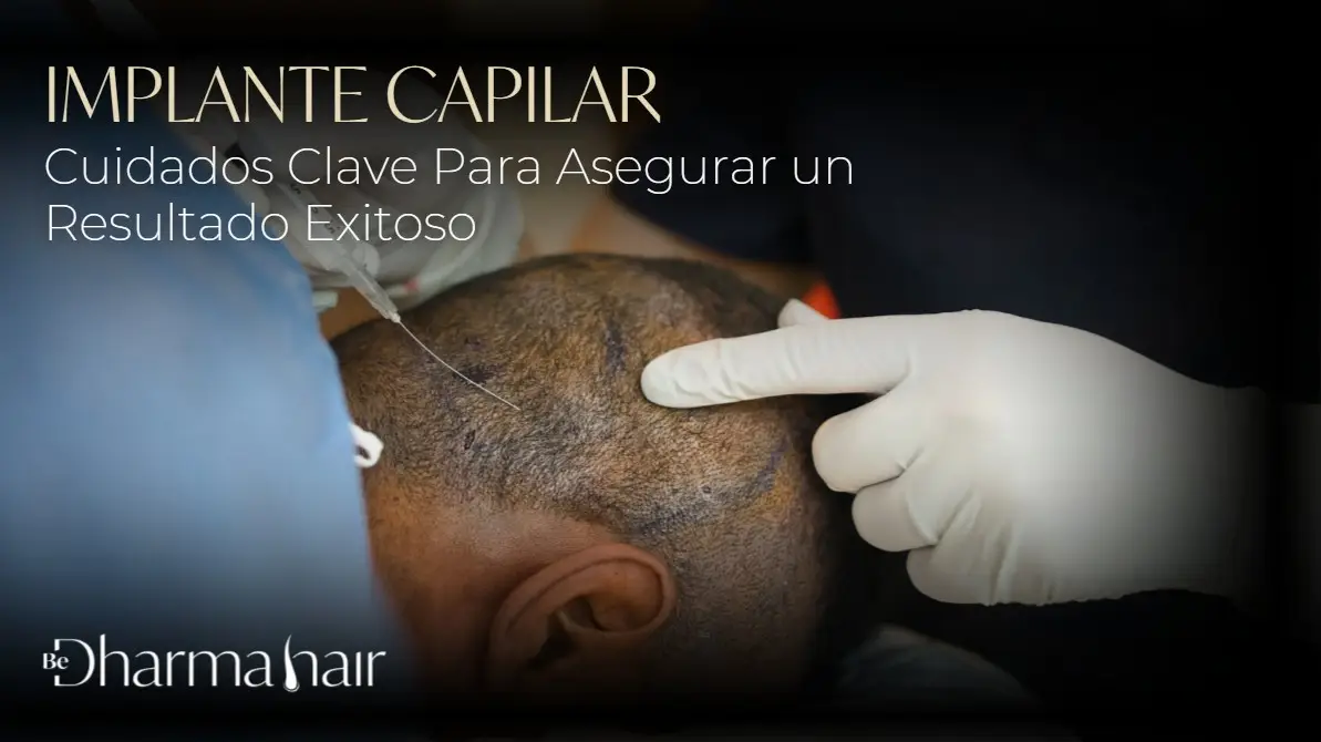 Cuidados implante capilar- Dharma Hair