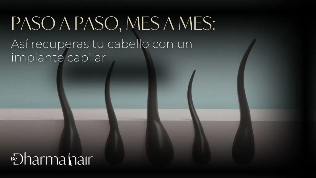 Implante capilar mes a mes - Dharma Hair implante capilar en Medellín