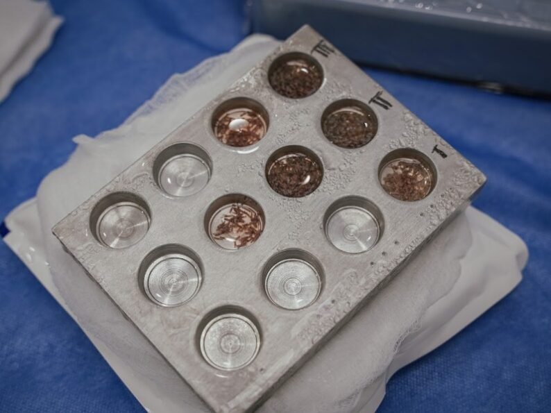 Folículos para implante capilar en Medellín - Dharma hair 2