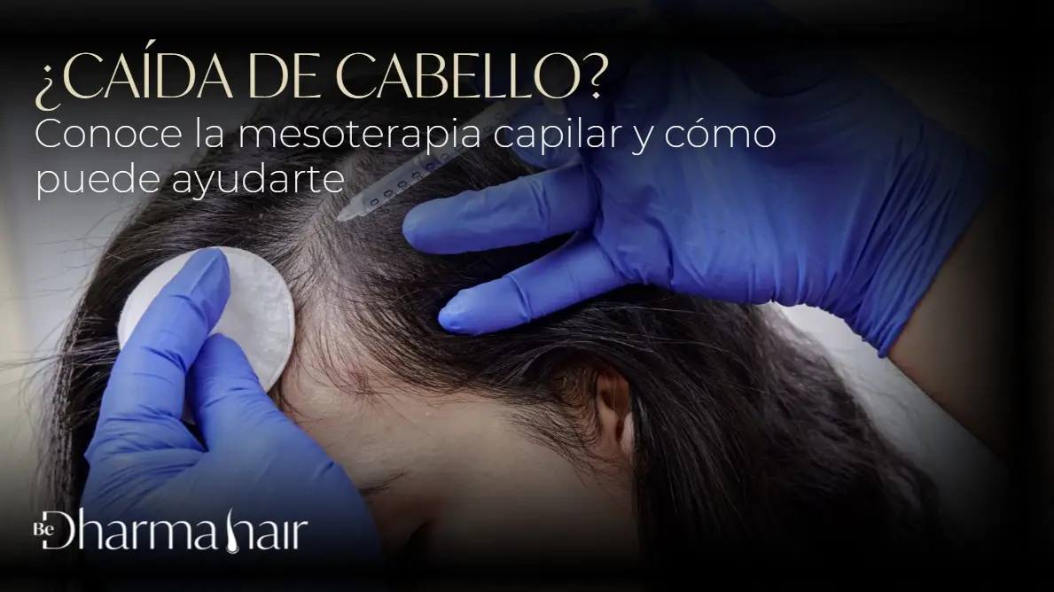 Mesoterapia capilar- Dharma Hair