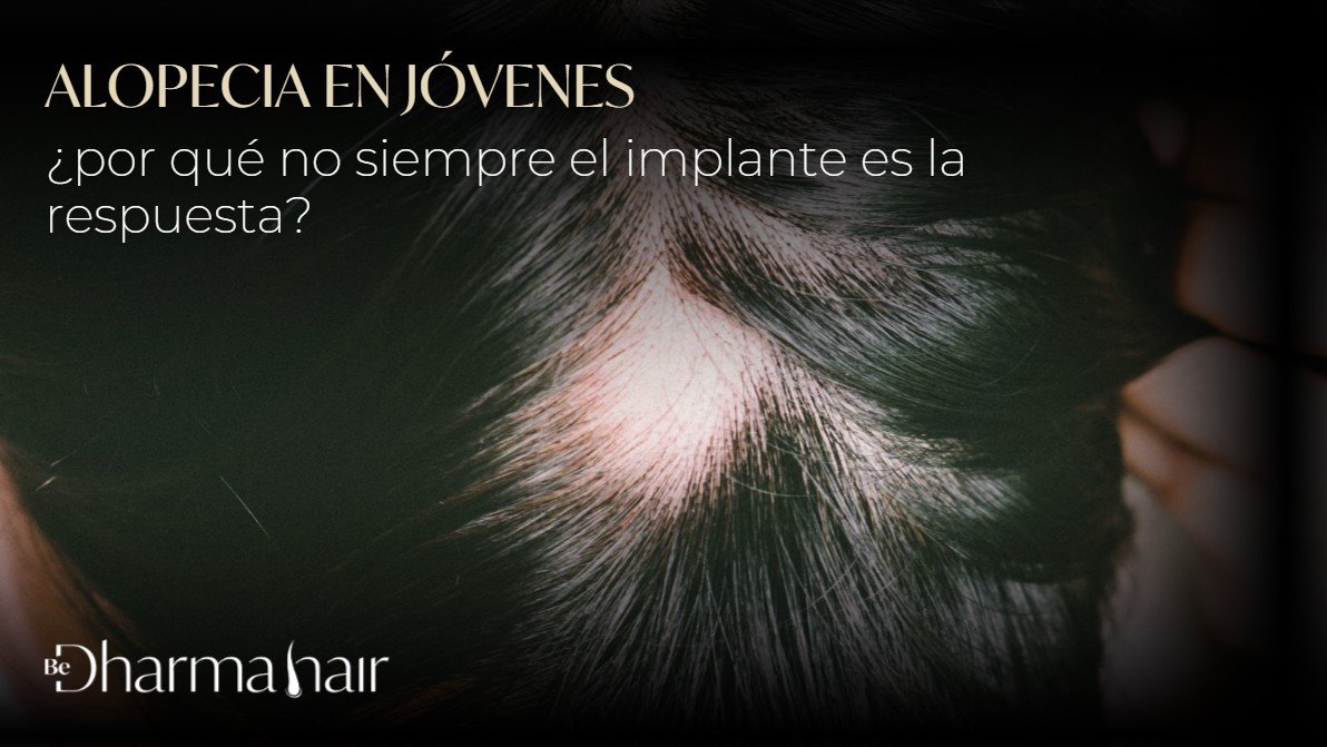 Alopecia en jóvenes-Dharma Hair