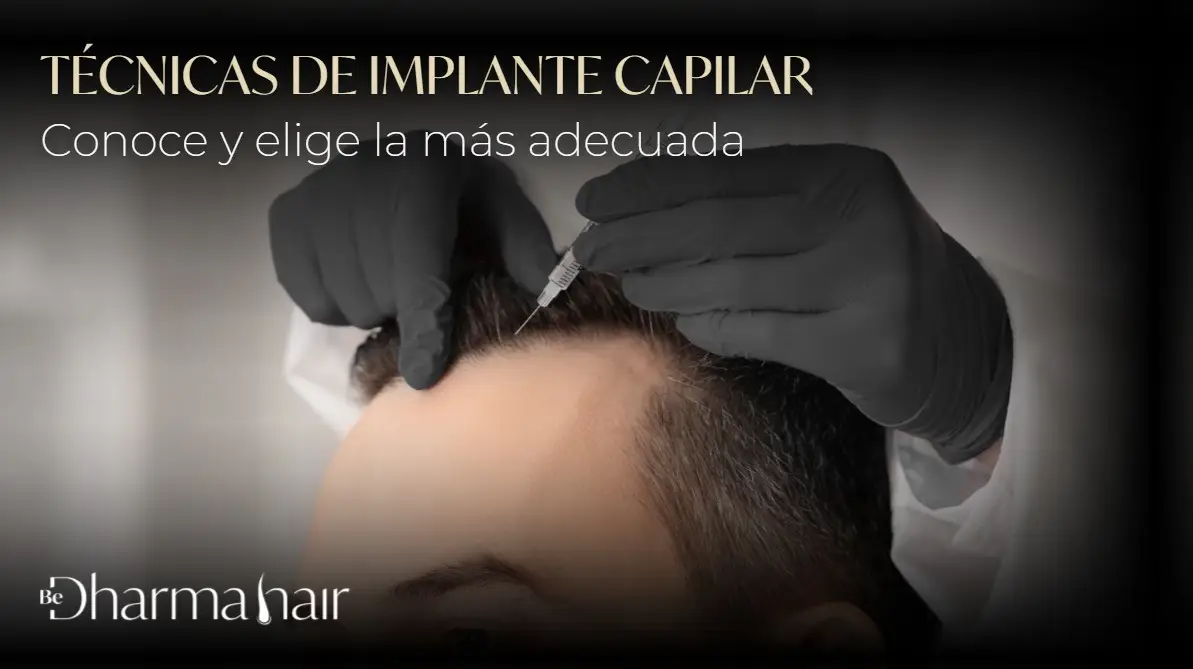 Técnicas de implante capilar- Dharma Hair