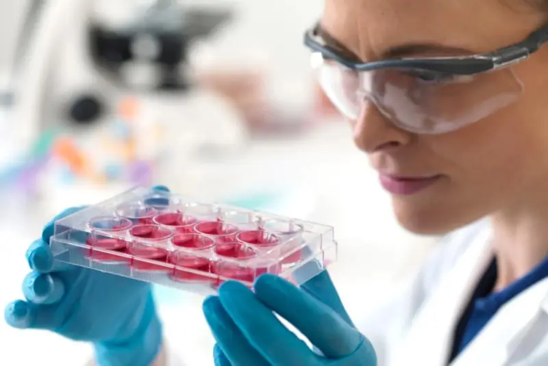 Tratamientos para la caída del cabello - células madre - clínica Dharma Hair en Medellín