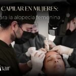 Implante Capilar en Mujeres Solución para la Alopecia Femenina - Be Dherma Hair - Medellín Colombia