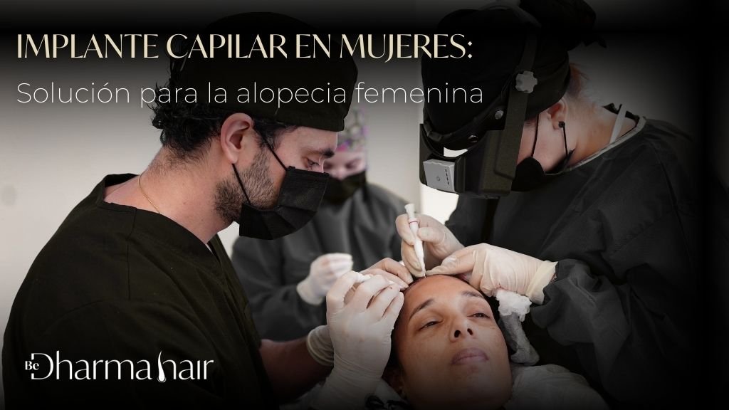 Implante Capilar en Mujeres Solución para la Alopecia Femenina - Be Dherma Hair - Medellín Colombia