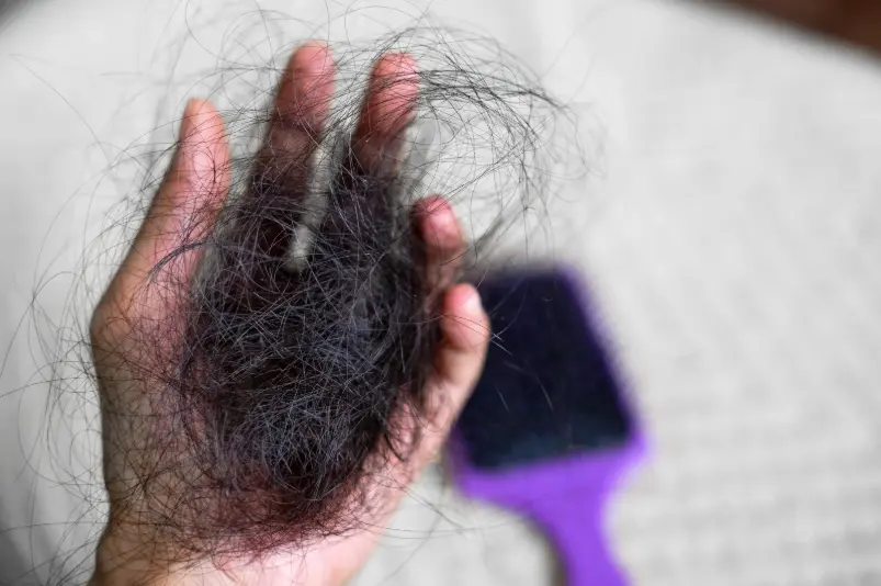 Causas de la caída del cabello en mujeres-Dharma Hair Medellín