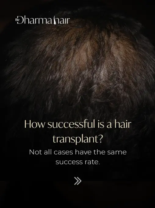 Hair implant sucess rate-Dharma Hair