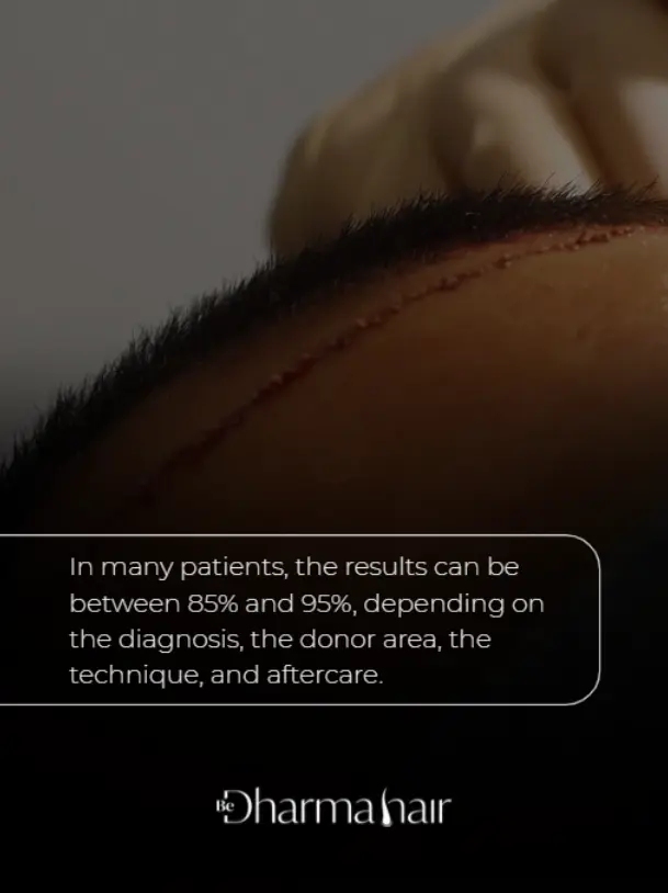 Hair implant sucess rate-Dharma Hair