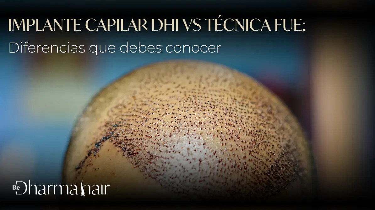 Implante capilar DHI vs técnica FUE - Dharma Hair