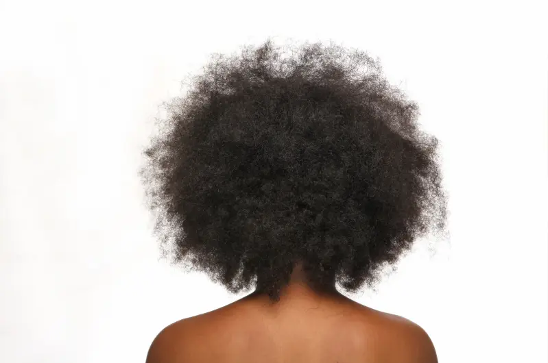 implante capilar en cabello afro-Dharma Hair