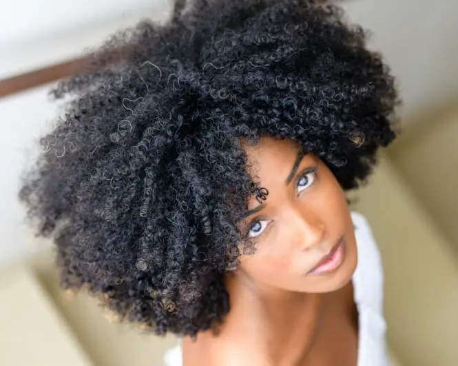 implante capilar en cabello afro-Dharma Hair