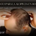 Tratamiento para la alopecia en hombres cómo saber cuál necesitas - Be Dharma Hair
