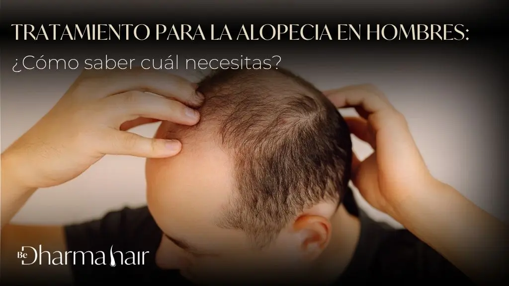 Tratamiento para la alopecia en hombres cómo saber cuál necesitas - Be Dharma Hair