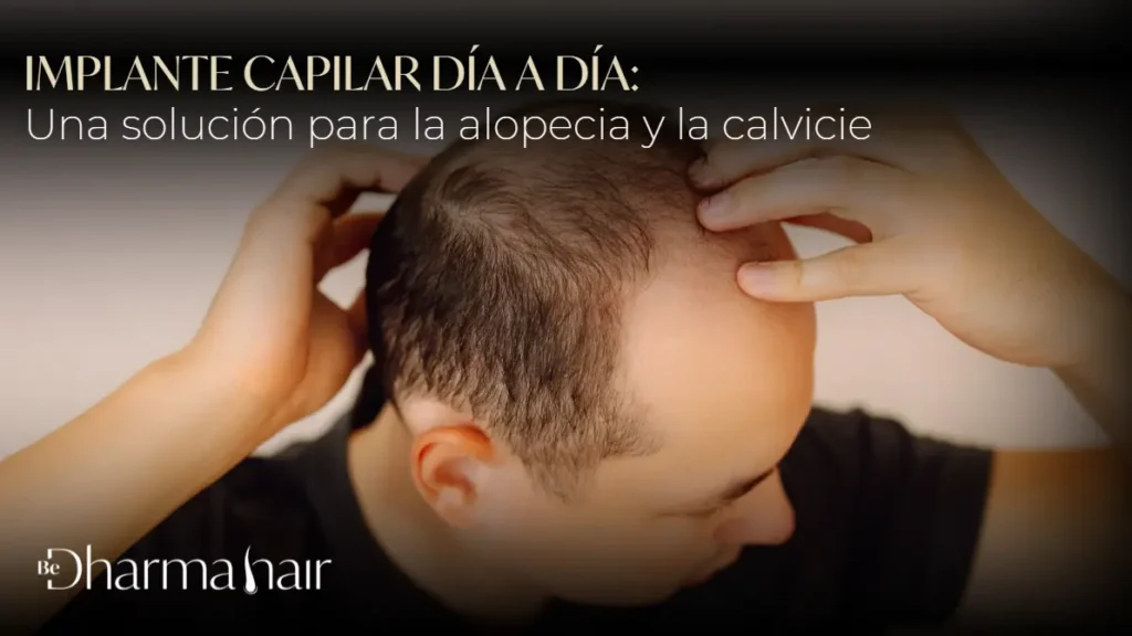 Implante capilar día a día- Dharma Hair