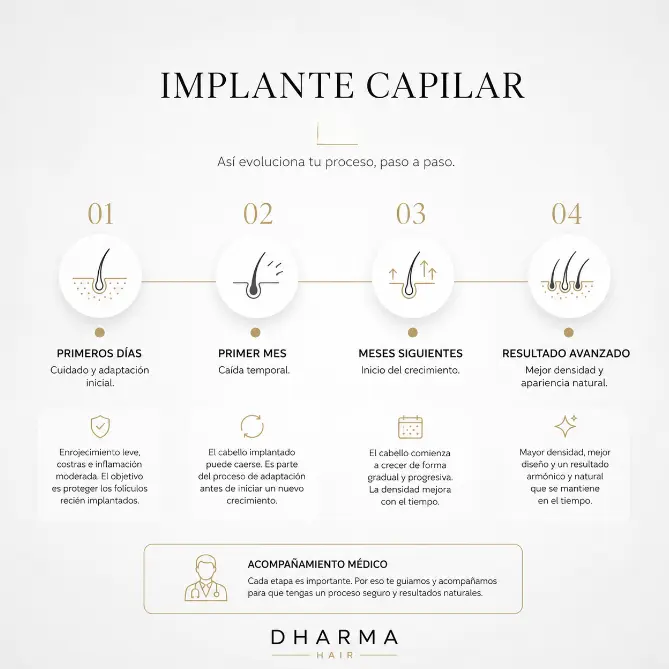 Implante capilar día a día- Dharma Hair Medellín