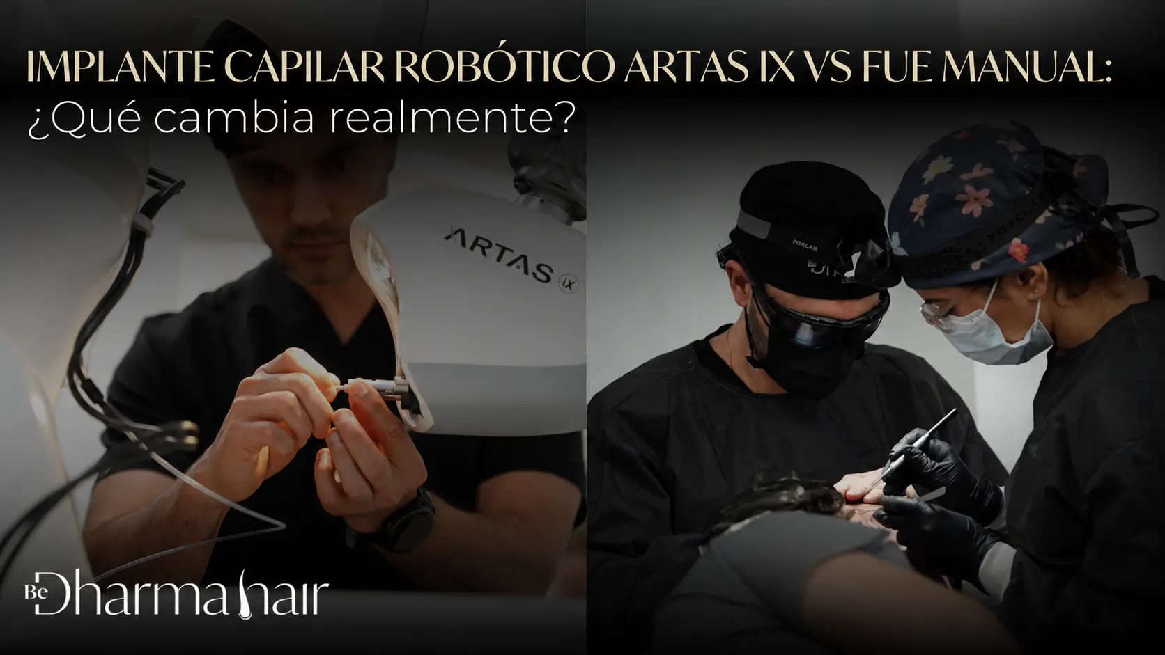 Implante capilar robótico ARTAS iX vs FUE manual-Dharma Hair en Medellín, Colombia