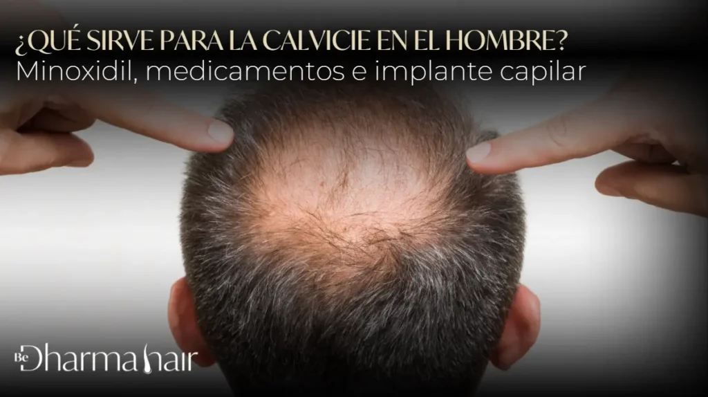 Qué sirve para la calvicie en el hombre- Dharma Hair Medellín