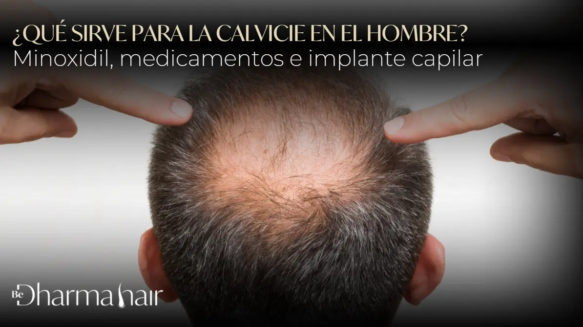 Qué sirve para la calvicie en el hombre- Dharma Hair Medellín