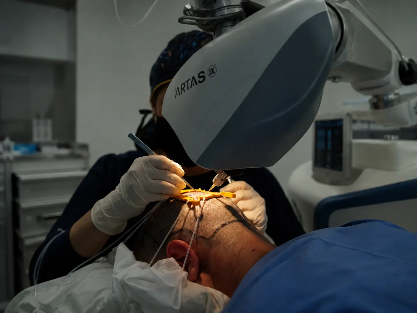 ARTAS iX robotic hair transplant procedure at Dharma Hair in Medellín