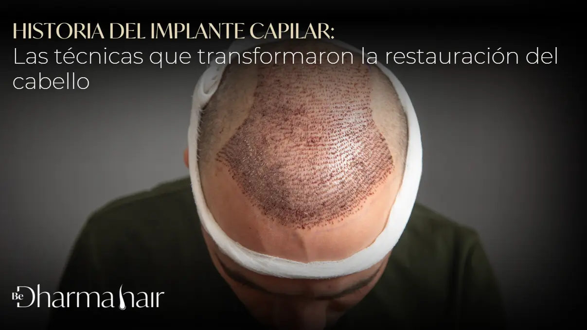 Evolución del implante capilar- Dharma Hair en Medellín