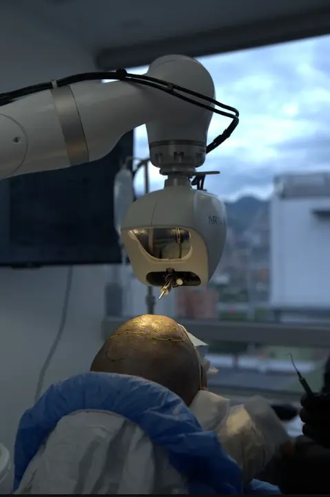 ARTAS iX robotic arm positioned over a patient's scalp during a hair transplant at Dharma Hair