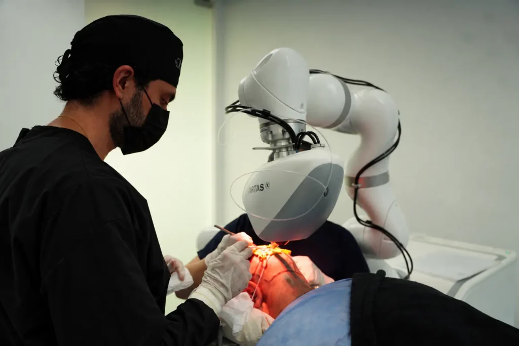 Dharma Hair surgeon working next to the ARTAS iX robot during a robotic hair transplant in Medellín
