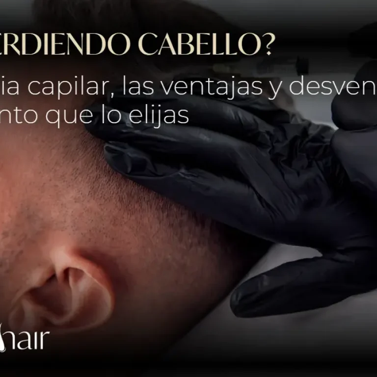 ¿Cuándo sí es recomendable una mesoterapia capilar?-Dharma Hair