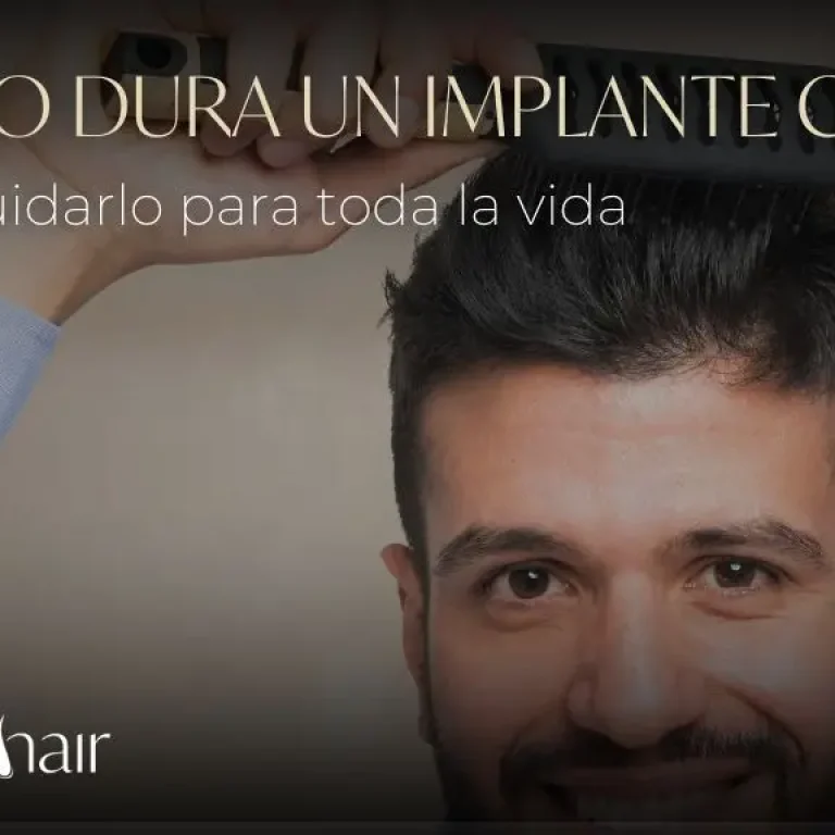 Cuánto dura un implante capilar y cómo cuidarlo para toda la vida - Dharma hair