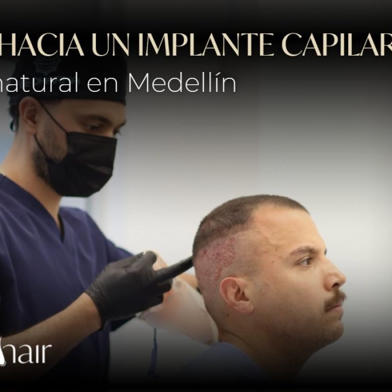 Implante capilar en Medellín- Dharma Hair
