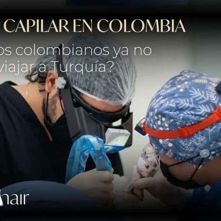 Implante capilar en Turquía o Medellín-Dharma Hair