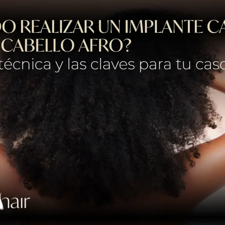 implante capilar en cabello afro-Dharma Hair