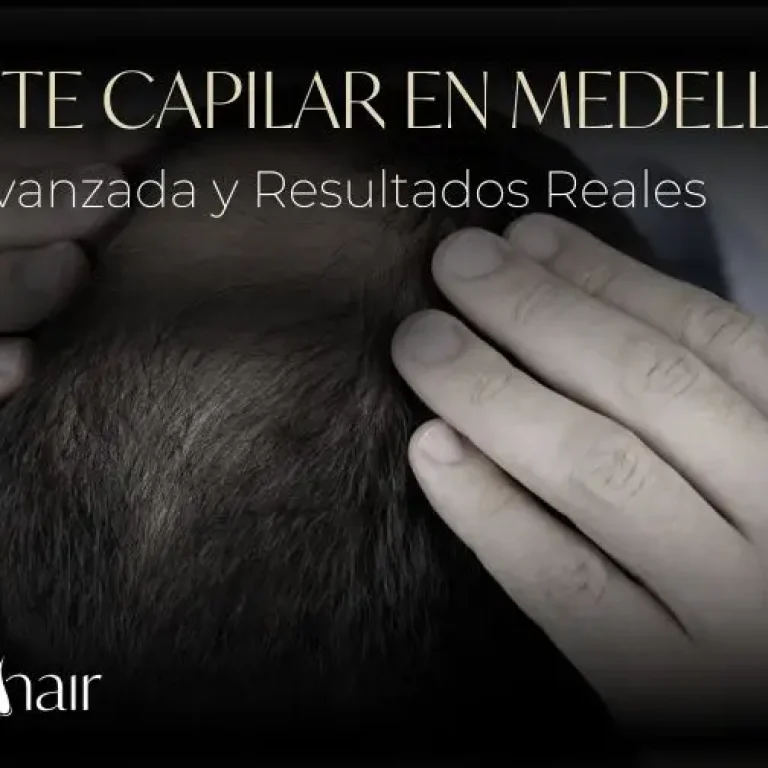 Implante capilar en Medellín - Be Dharma Hair en Medellín
